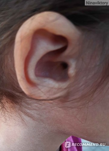 Прокалывание ушей детям - «Почему я не советую прокалывать уши маленькимдевочкам и когда лучше всего это сделать? Как снять медицинские пусеты,серьги-иглы или клипсы?»