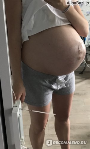 Тянет живот 40 недель беременности