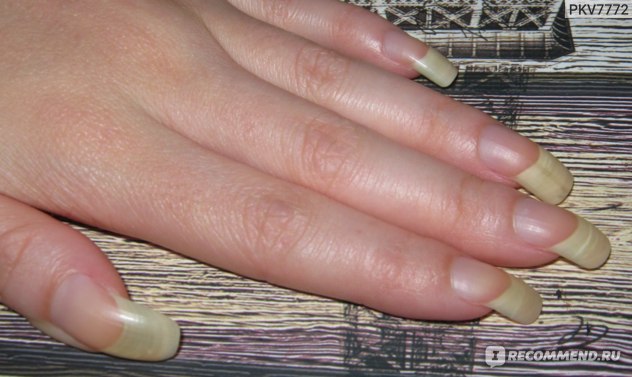 Запечатывание ногтей: эффективное решение против ломкости и расслоения