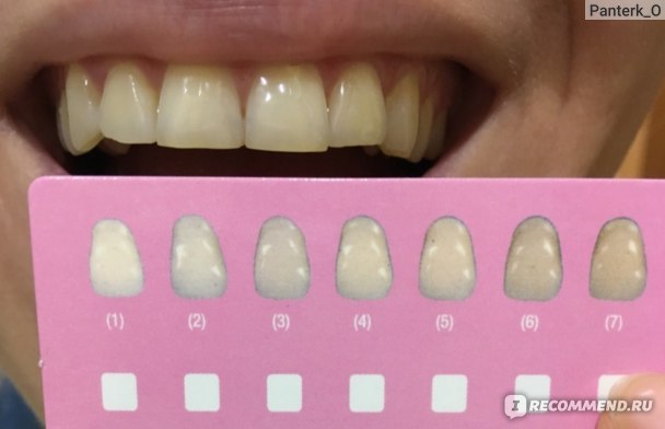 Цвет зубов после отбеливания зубов temp bond