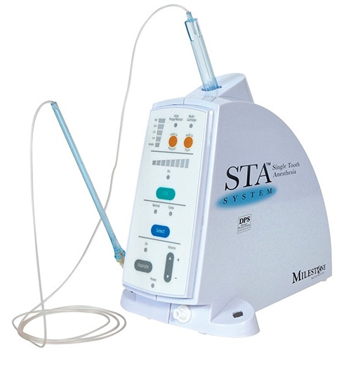 Компьютерная анестезия Milestone STA System | отзывы
